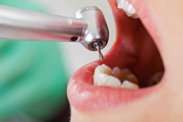 Best Emergency Dentist for Knocked-Out Tooth in Rossford, OH